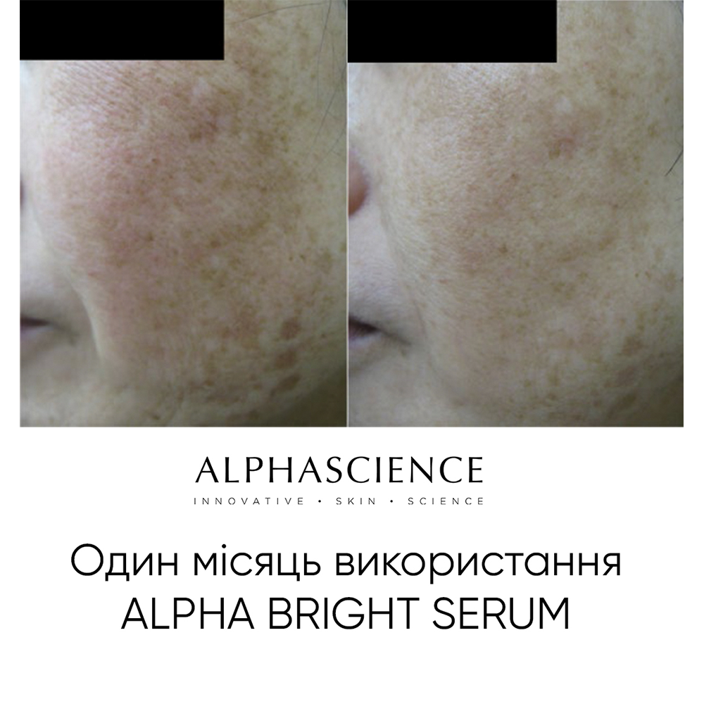 Alpha Bright Serum від Alphascience — французька професійна